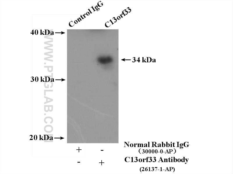 Immunoprecipitation (IP) experiment of HepG2 cells using C13orf33 Polyclonal antibody (26137-1-AP)