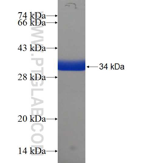 C13orf37 fusion protein Ag21699 SDS-PAGE