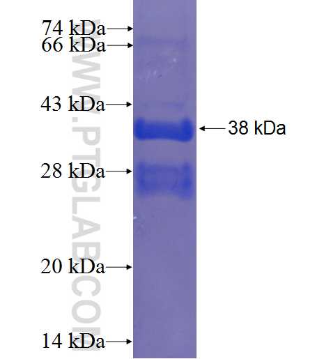 C13orf39 fusion protein Ag23418 SDS-PAGE