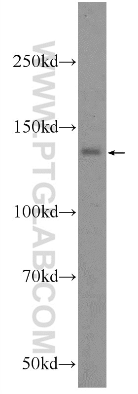 Western Blot (WB) analysis of MCF-7 cells using NRDE2 Polyclonal antibody (24968-1-AP)