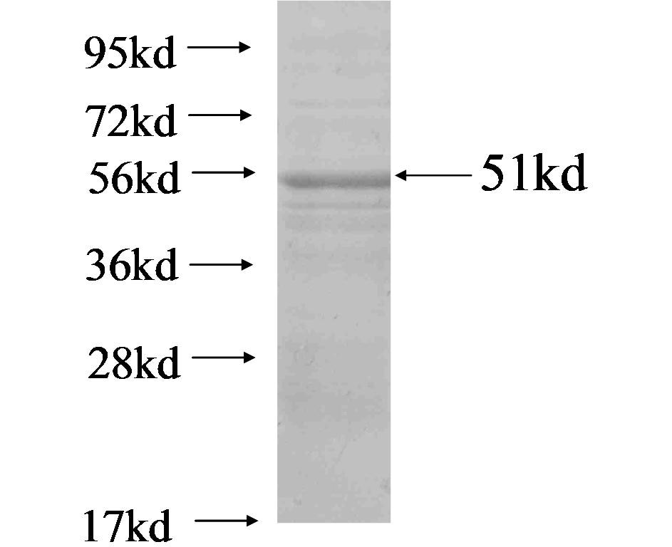 C14orf104 fusion protein Ag19741 SDS-PAGE