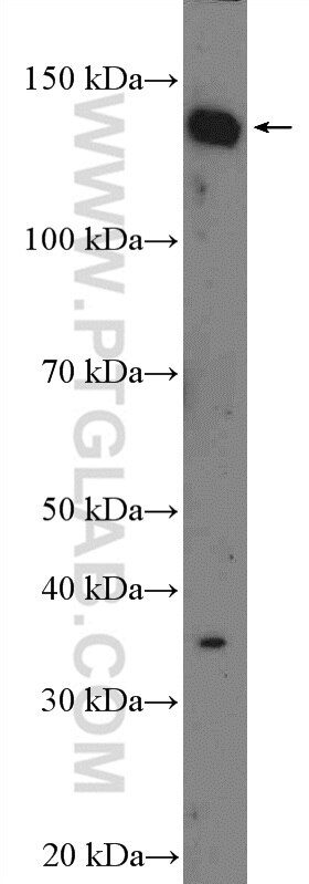 Western Blot (WB) analysis of HEK-293 cells using MIS18BP1 Polyclonal antibody (26264-1-AP)