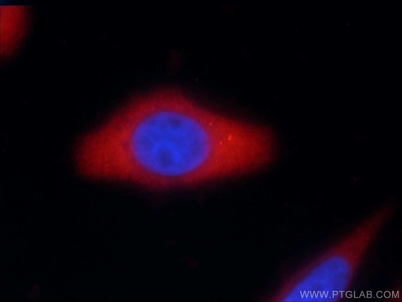 Immunofluorescence (IF) / fluorescent staining of HepG2 cells using Vertnin Polyclonal antibody (24824-1-AP)