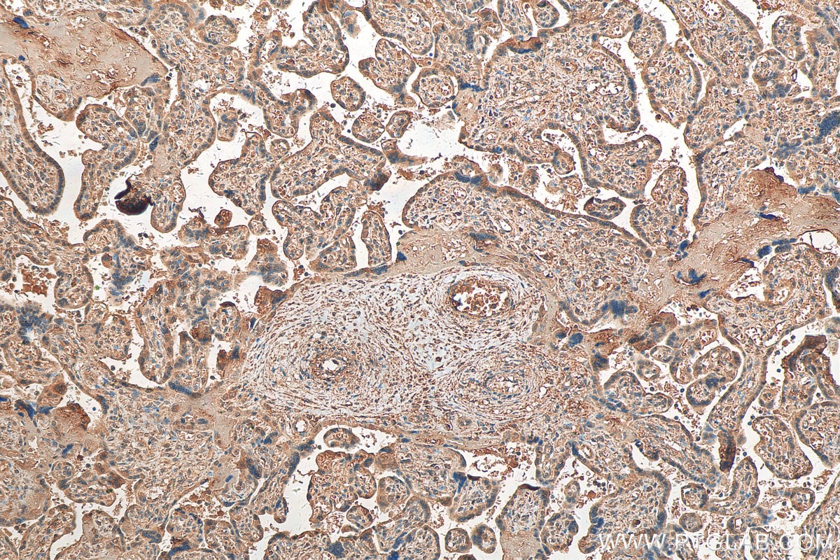 Immunohistochemistry (IHC) staining of human placenta tissue using Vertnin Polyclonal antibody (24824-1-AP)