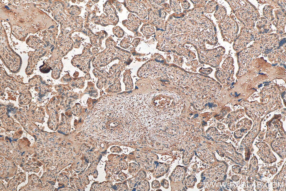 IHC staining of human placenta using 24824-1-AP