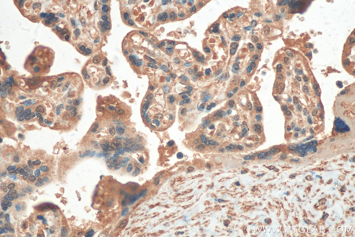 IHC staining of human placenta using 24824-1-AP