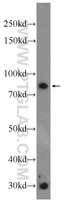 Western Blot (WB) analysis of SGC-7901 cells using Vertnin Polyclonal antibody (24824-1-AP)