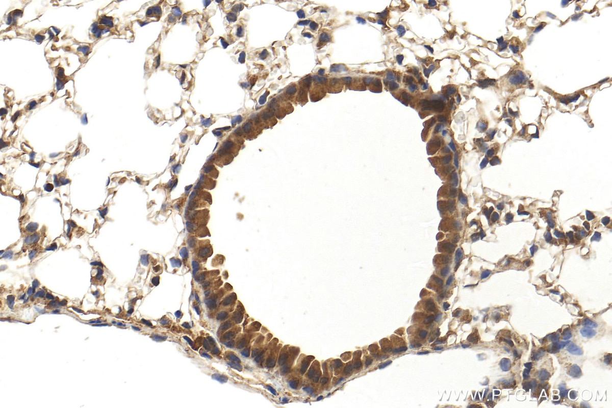 Immunohistochemistry (IHC) staining of mouse lung tissue using C14orf126 Polyclonal antibody (23923-1-AP)