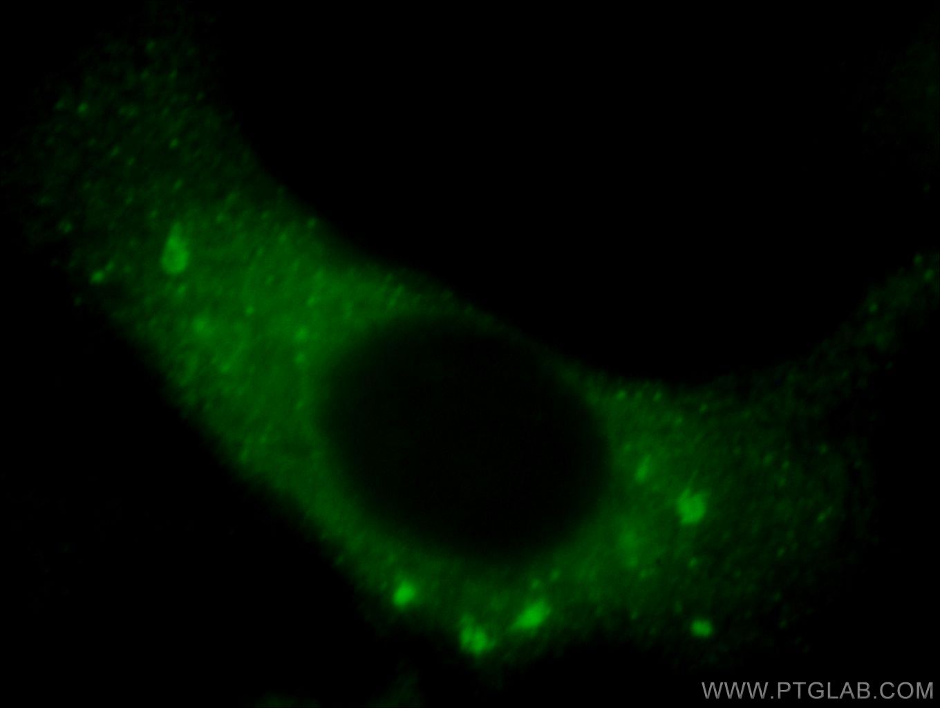 Immunofluorescence (IF) / fluorescent staining of HeLa cells using VIPAS39 Polyclonal antibody (20771-1-AP)