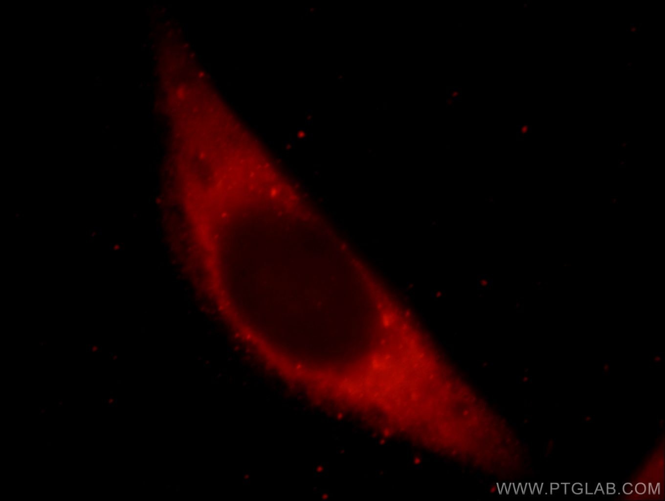 Immunofluorescence (IF) / fluorescent staining of HeLa cells using VIPAS39 Polyclonal antibody (20771-1-AP)