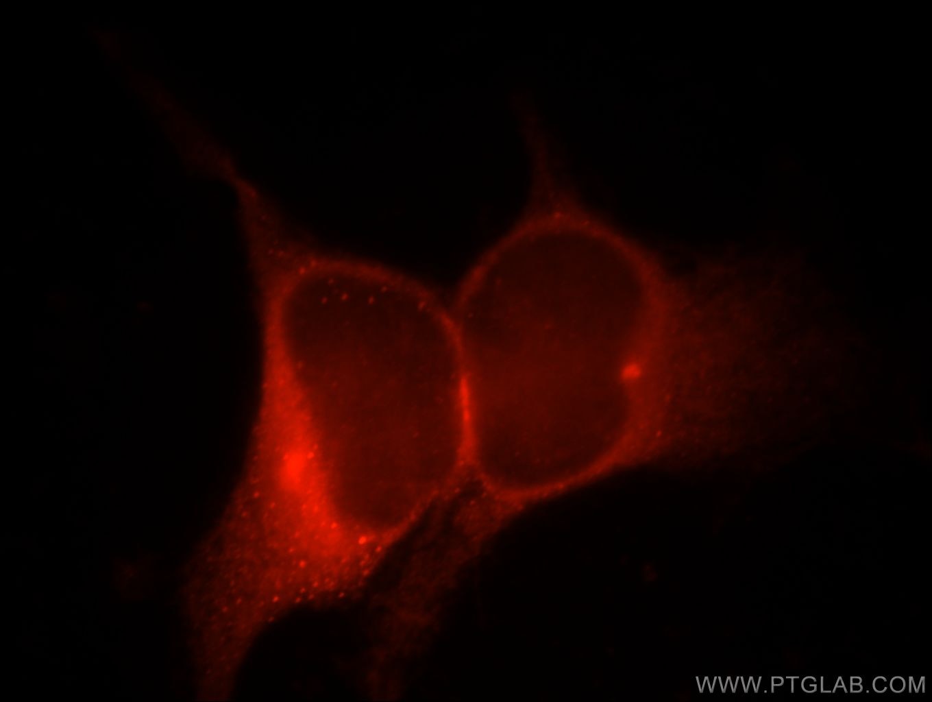 Immunofluorescence (IF) / fluorescent staining of HEK-293 cells using VIPAS39 Polyclonal antibody (20771-1-AP)