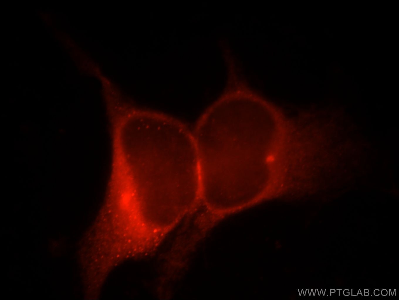 IF Staining of HEK-293 using 20771-1-AP