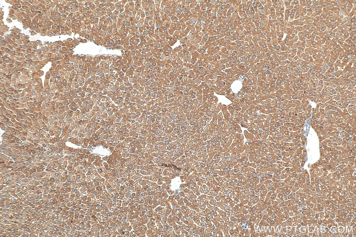Immunohistochemistry (IHC) staining of mouse liver tissue using VIPAS39 Polyclonal antibody (20771-1-AP)