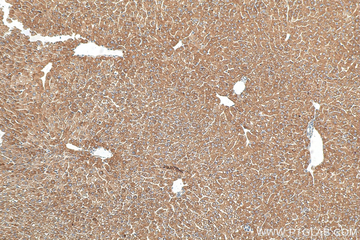 IHC staining of mouse liver using 20771-1-AP