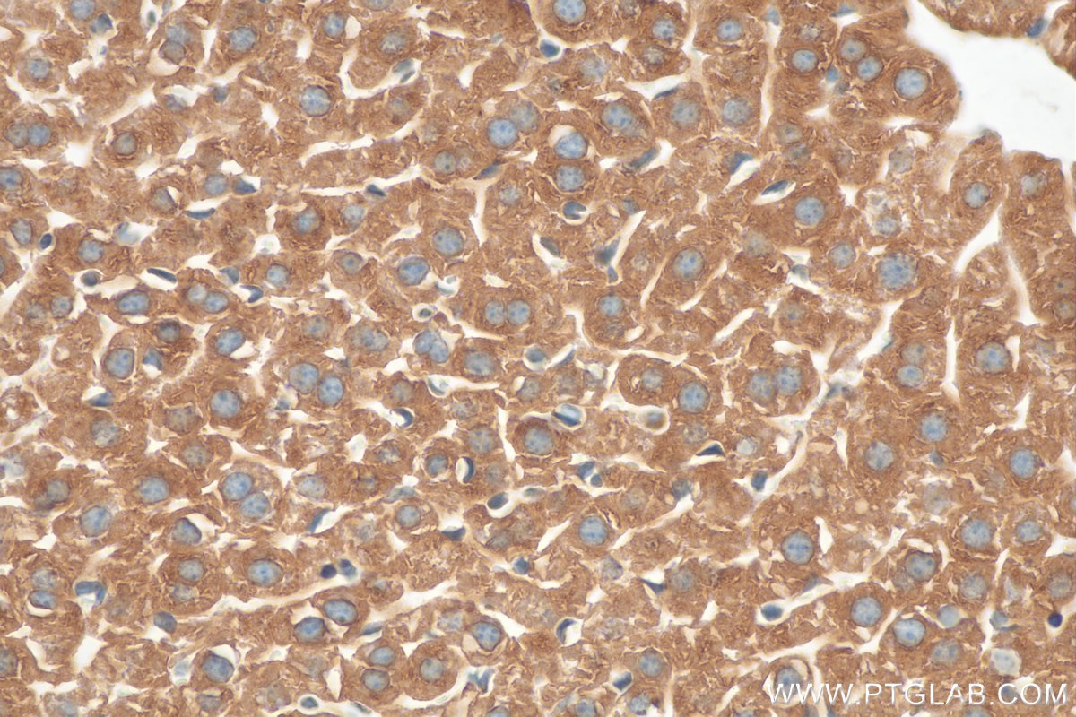 Immunohistochemistry (IHC) staining of mouse liver tissue using VIPAS39 Polyclonal antibody (20771-1-AP)