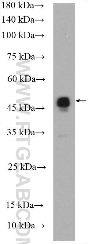 Western Blot (WB) analysis of mouse brain tissue using VIPAS39 Polyclonal antibody (20771-1-AP)