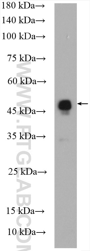 WB analysis of mouse brain using 20771-1-AP