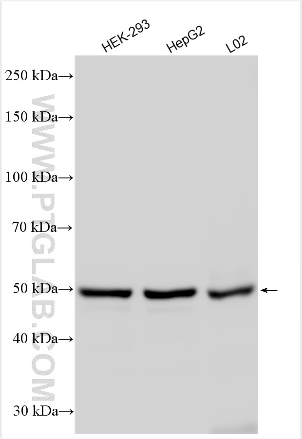 Western Blot (WB) analysis of various lysates using VIPAS39 Polyclonal antibody (20771-1-AP)