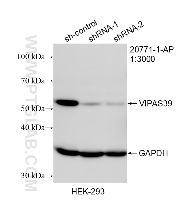 Western Blot (WB) analysis of HEK-293 cells using VIPAS39 Polyclonal antibody (20771-1-AP)
