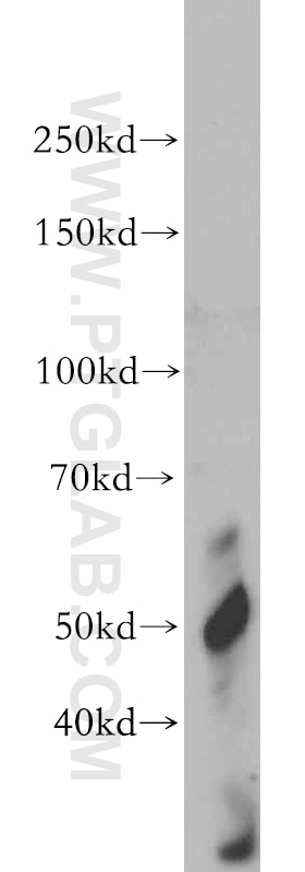 Western Blot (WB) analysis of human kidney tissue using VIPAS39 Polyclonal antibody (20771-1-AP)