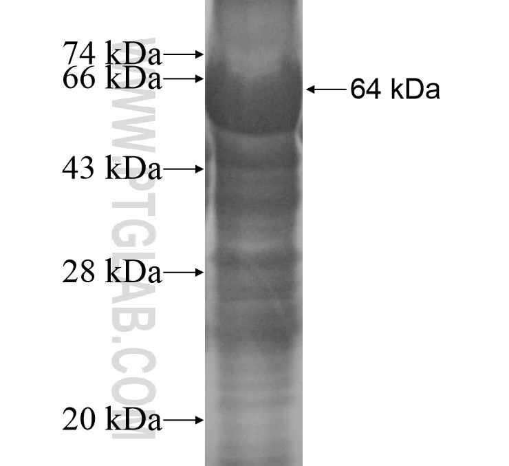 VIPAS39 fusion protein Ag14762 SDS-PAGE