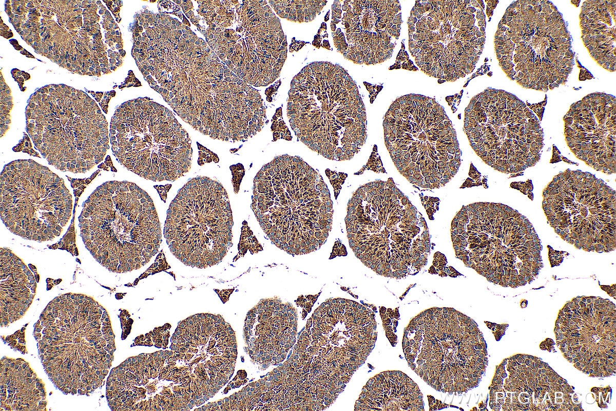 Immunohistochemistry (IHC) staining of mouse testis tissue using C14orf138 Polyclonal antibody (24722-1-AP)