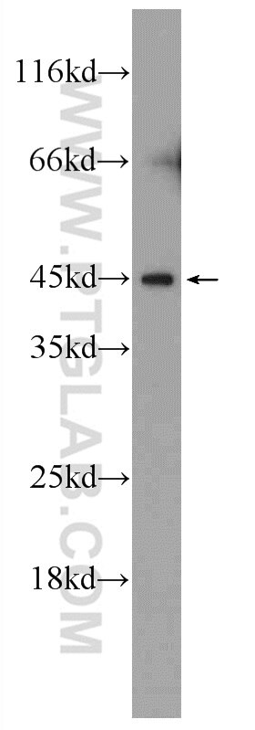 Western Blot (WB) analysis of human testis tissue using C14orf138 Polyclonal antibody (24722-1-AP)