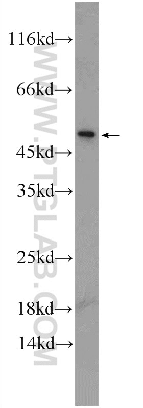 Western Blot (WB) analysis of PC-3 cells using C14orf138 Polyclonal antibody (24722-1-AP)