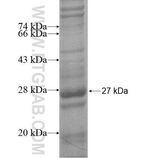 C14orf139 fusion protein Ag15782 SDS-PAGE C14orf139 fusion protein Ag15782 SDS-PAGE