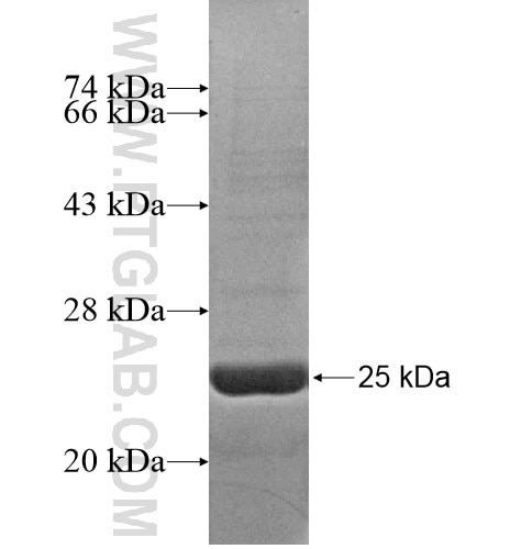 C14orf143 fusion protein Ag14835 SDS-PAGE