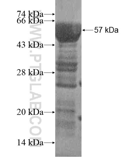 C14orf145 fusion protein Ag20610 SDS-PAGE