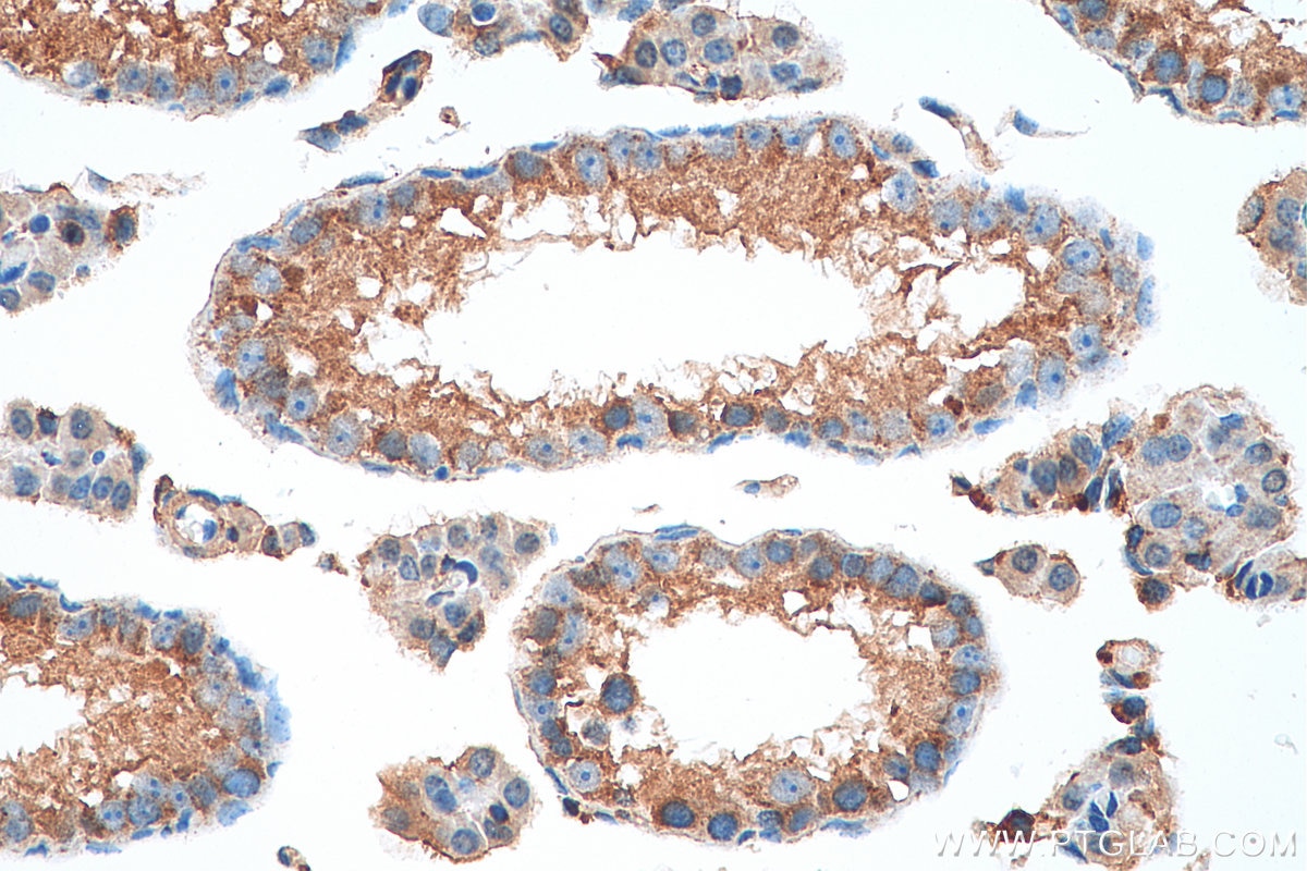 IHC staining of mouse testis using 26006-1-AP