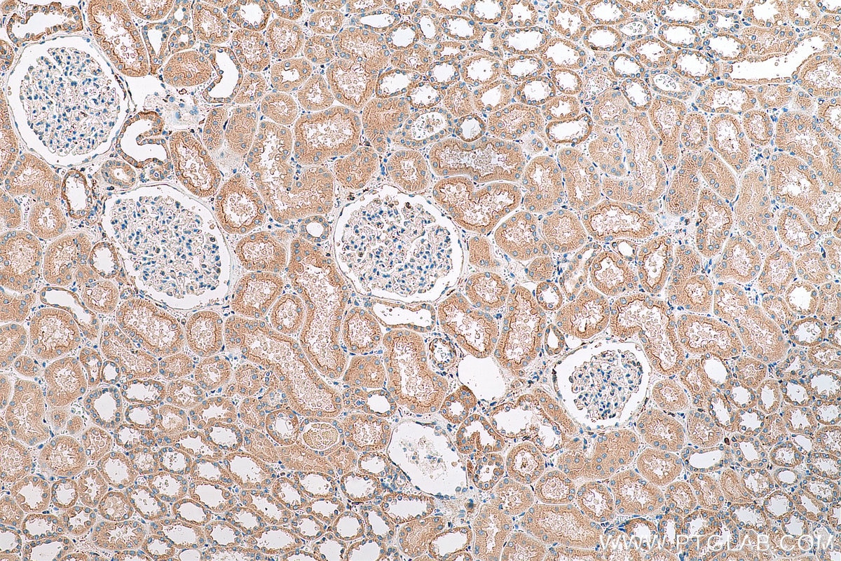 Immunohistochemistry (IHC) staining of human kidney tissue using SLIRP Polyclonal antibody (26006-1-AP)