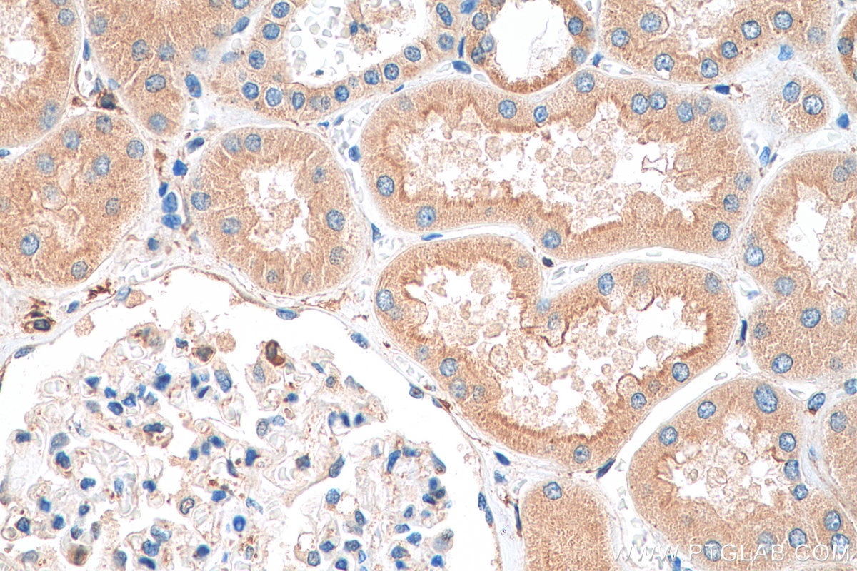 Immunohistochemistry (IHC) staining of human kidney tissue using SLIRP Polyclonal antibody (26006-1-AP)