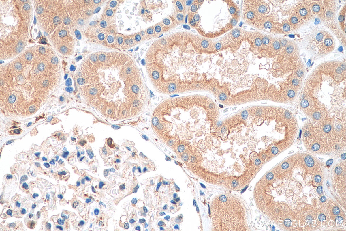 IHC staining of human kidney using 26006-1-AP