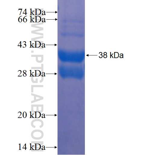 C14orf156 fusion protein Ag22945 SDS-PAGE
