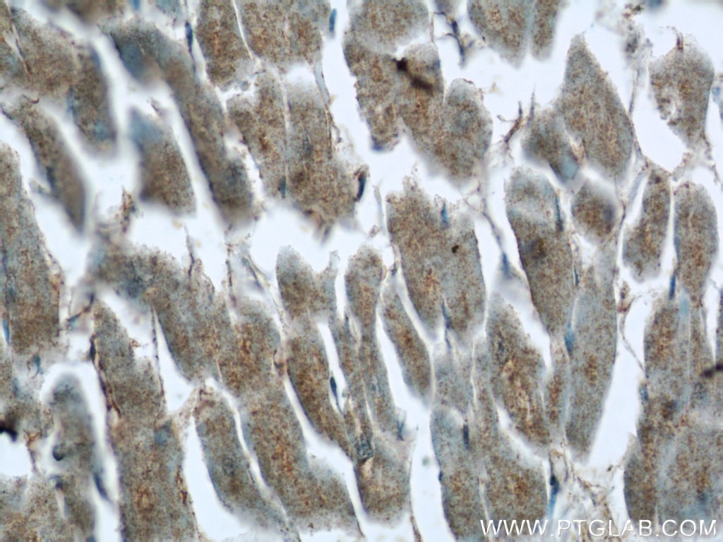 Immunohistochemistry (IHC) staining of human heart tissue using C14orf159 Polyclonal antibody (24737-1-AP)