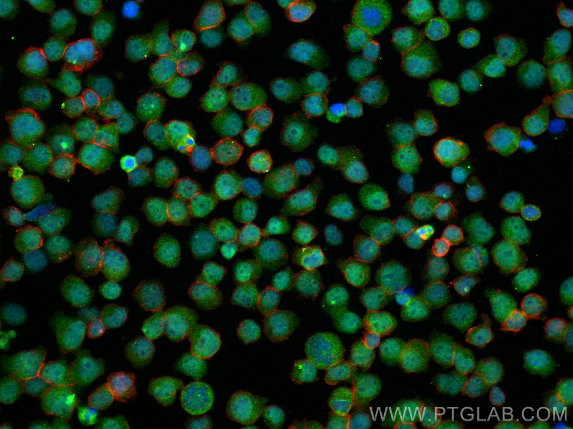Immunofluorescence (IF) / fluorescent staining of Jurkat cells using C14orf166 Polyclonal antibody (19848-1-AP)