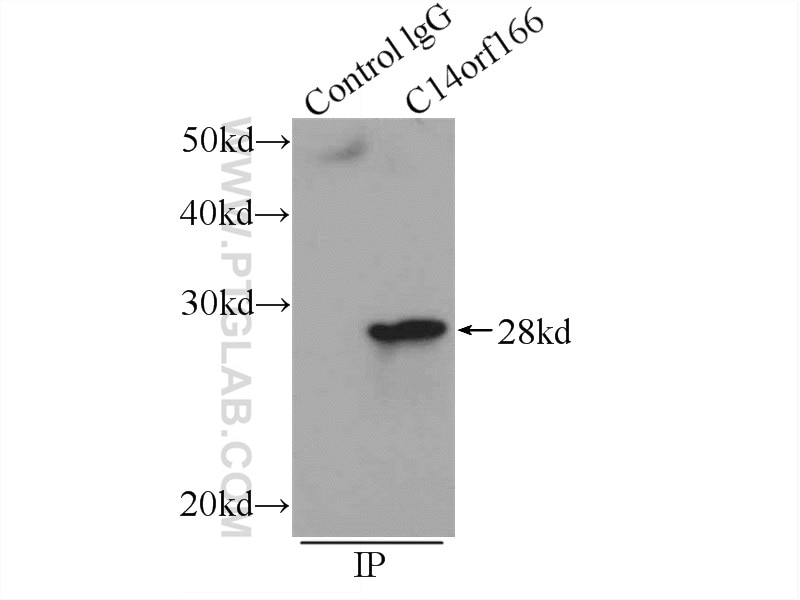 Immunoprecipitation (IP) experiment of Jurkat cells using C14orf166 Polyclonal antibody (19848-1-AP)