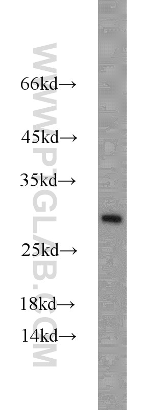 Western Blot (WB) analysis of mouse pancreas tissue using C14orf166 Polyclonal antibody (19848-1-AP)