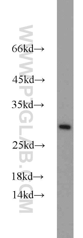 WB analysis of mouse pancreas using 19848-1-AP