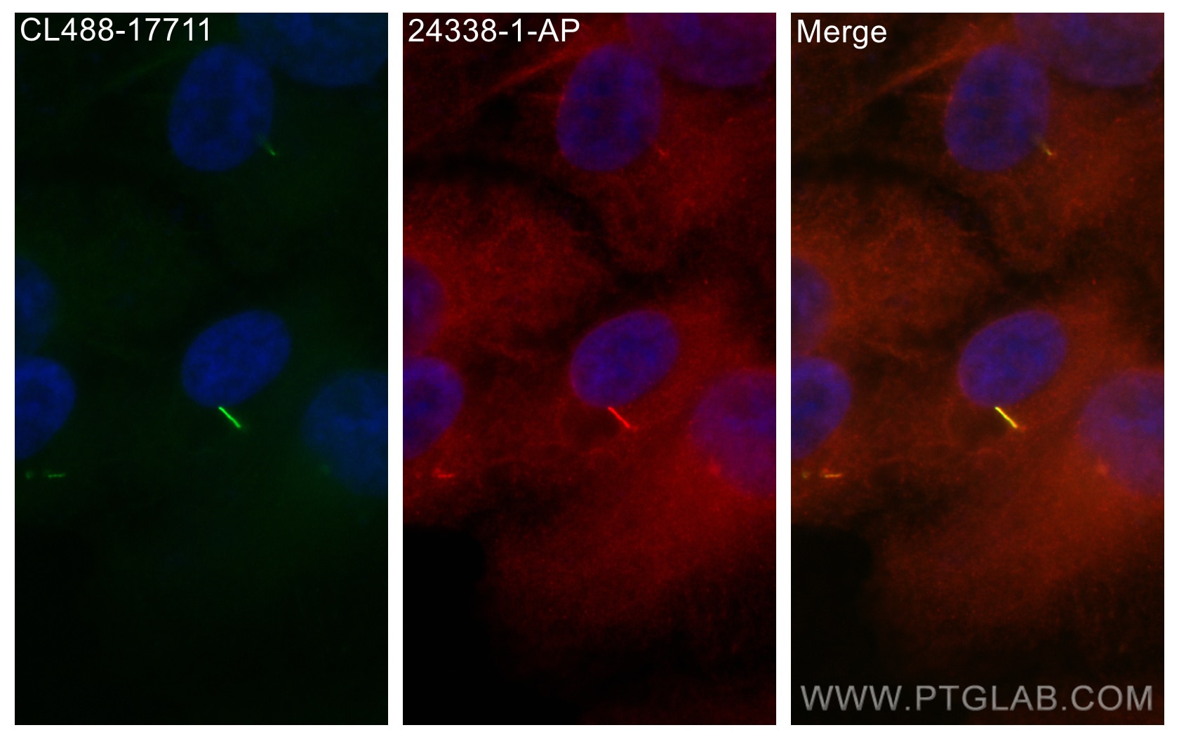 Immunofluorescence (IF) / fluorescent staining of hTERT-RPE1 cells using IFT43 Polyclonal antibody (24338-1-AP)