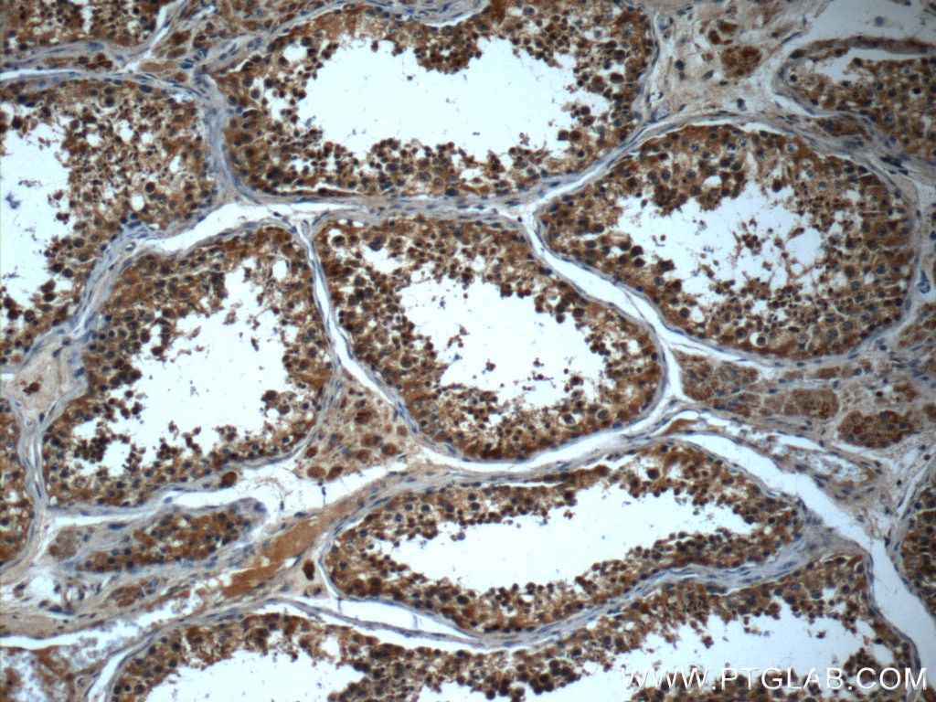 Immunohistochemistry (IHC) staining of human testis tissue using IFT43 Polyclonal antibody (24338-1-AP)