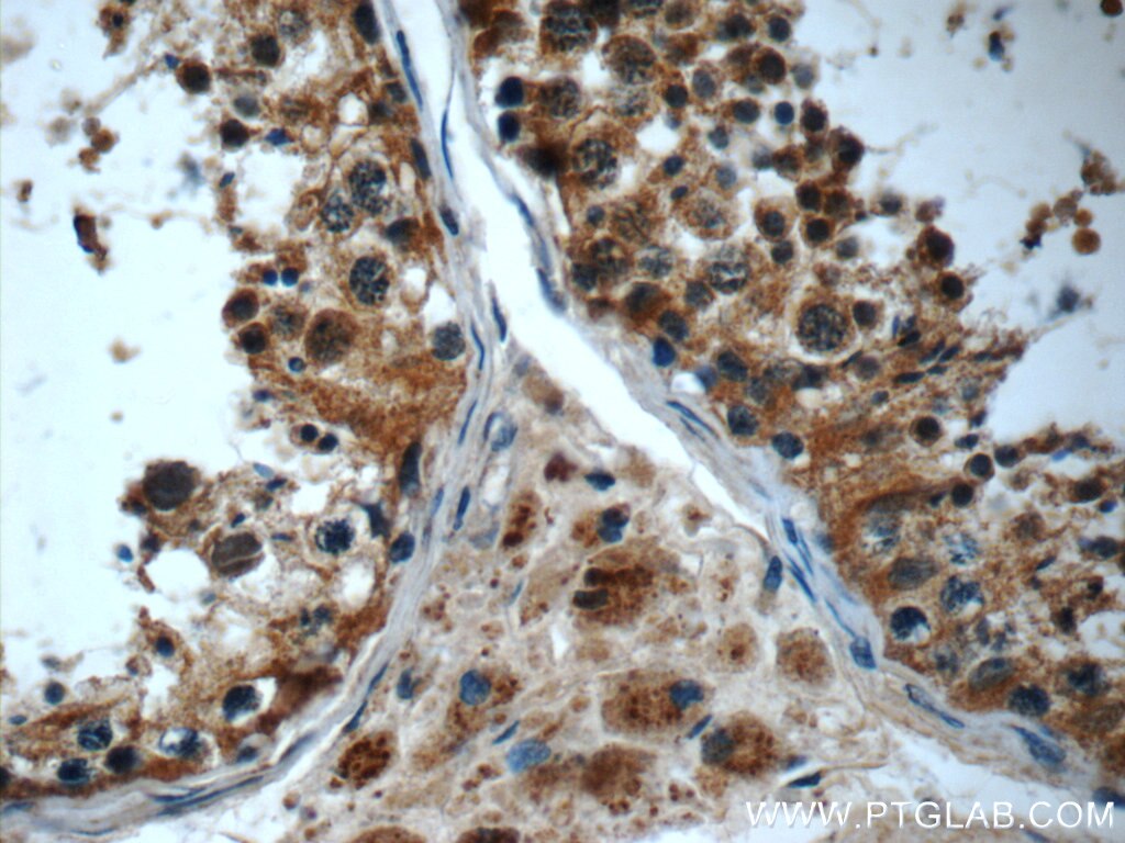 Immunohistochemistry (IHC) staining of human testis tissue using IFT43 Polyclonal antibody (24338-1-AP)