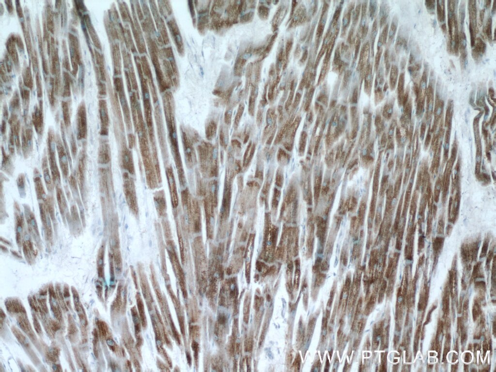 Immunohistochemistry (IHC) staining of human heart tissue using C14orf2 Polyclonal antibody (14704-1-AP)