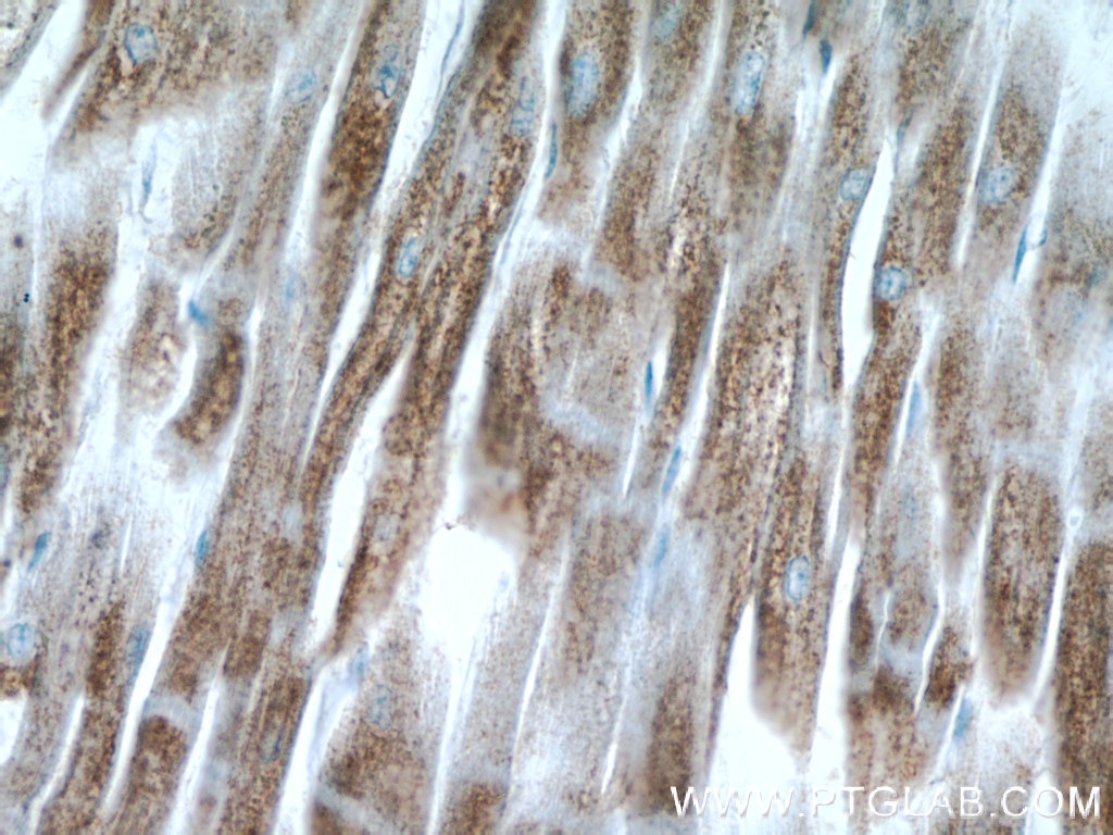 Immunohistochemistry (IHC) staining of human heart tissue using C14orf2 Polyclonal antibody (14704-1-AP)