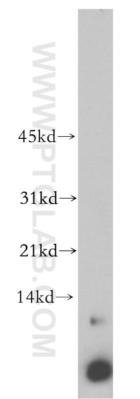 Western Blot (WB) analysis of Jurkat cells using C14orf2 Polyclonal antibody (14704-1-AP)