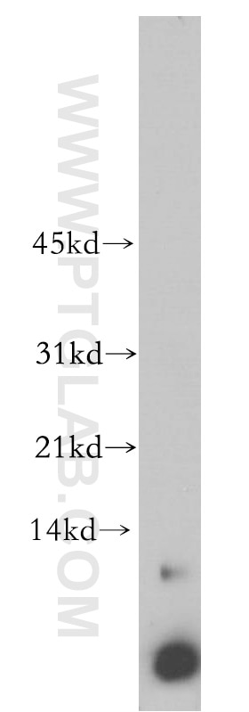 WB analysis of Jurkat using 14704-1-AP