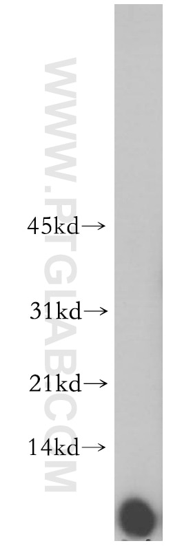 Western Blot (WB) analysis of human brain tissue using C14orf2 Polyclonal antibody (14704-1-AP)