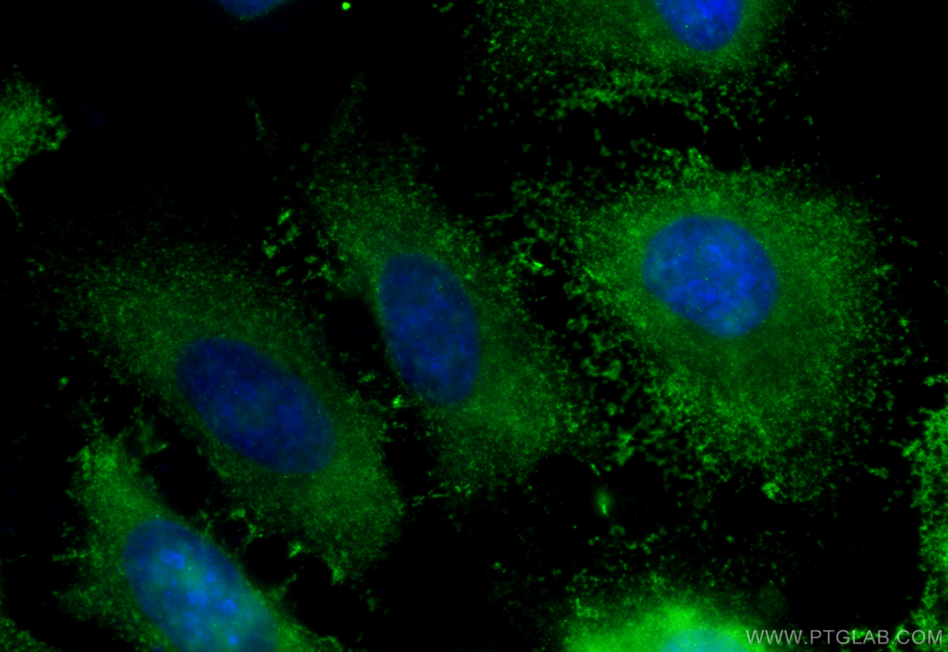 Immunofluorescence (IF) / fluorescent staining of HeLa cells using C14orf28 Polyclonal antibody (26130-1-AP)